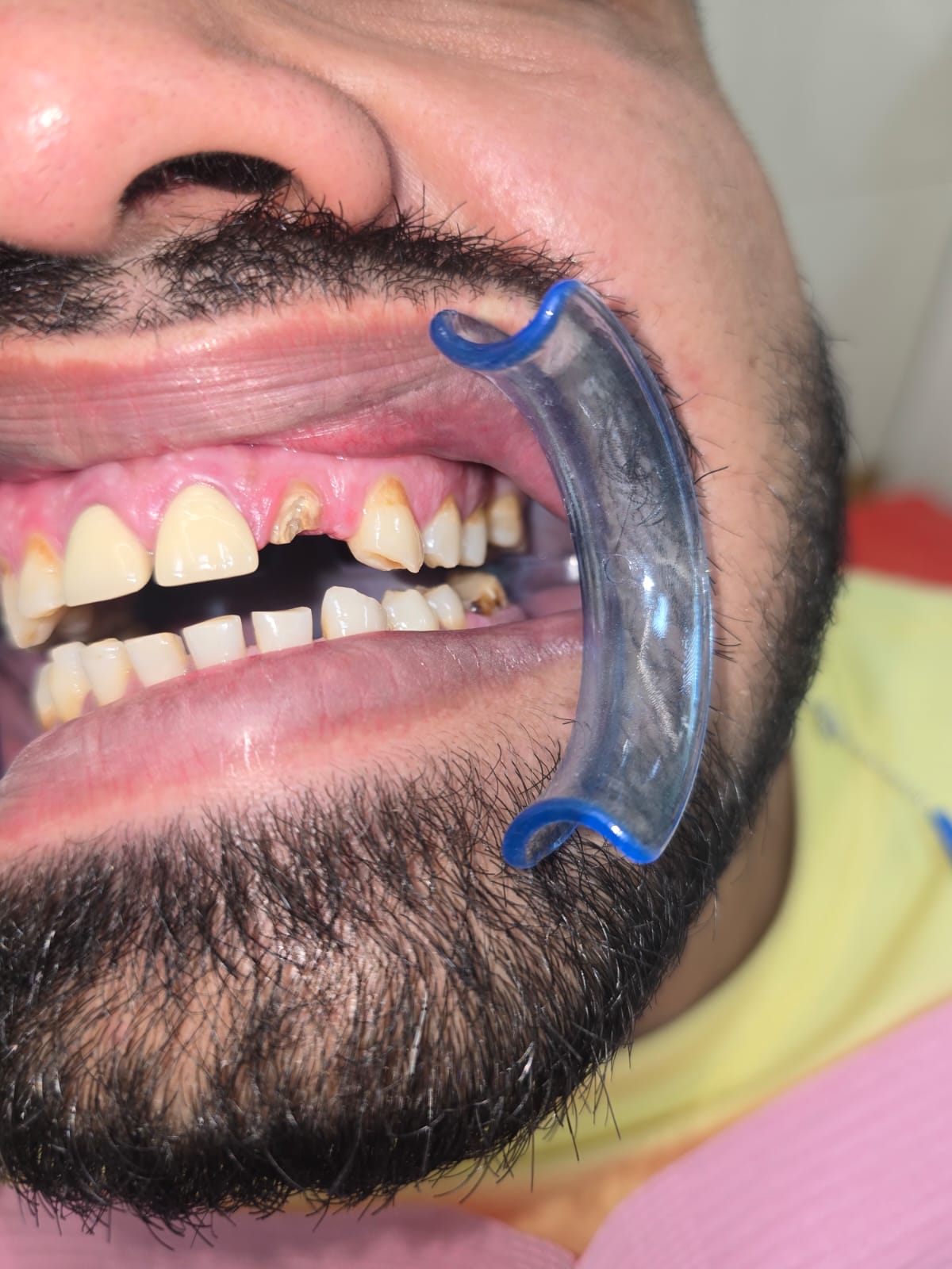 Emergency Dentistry