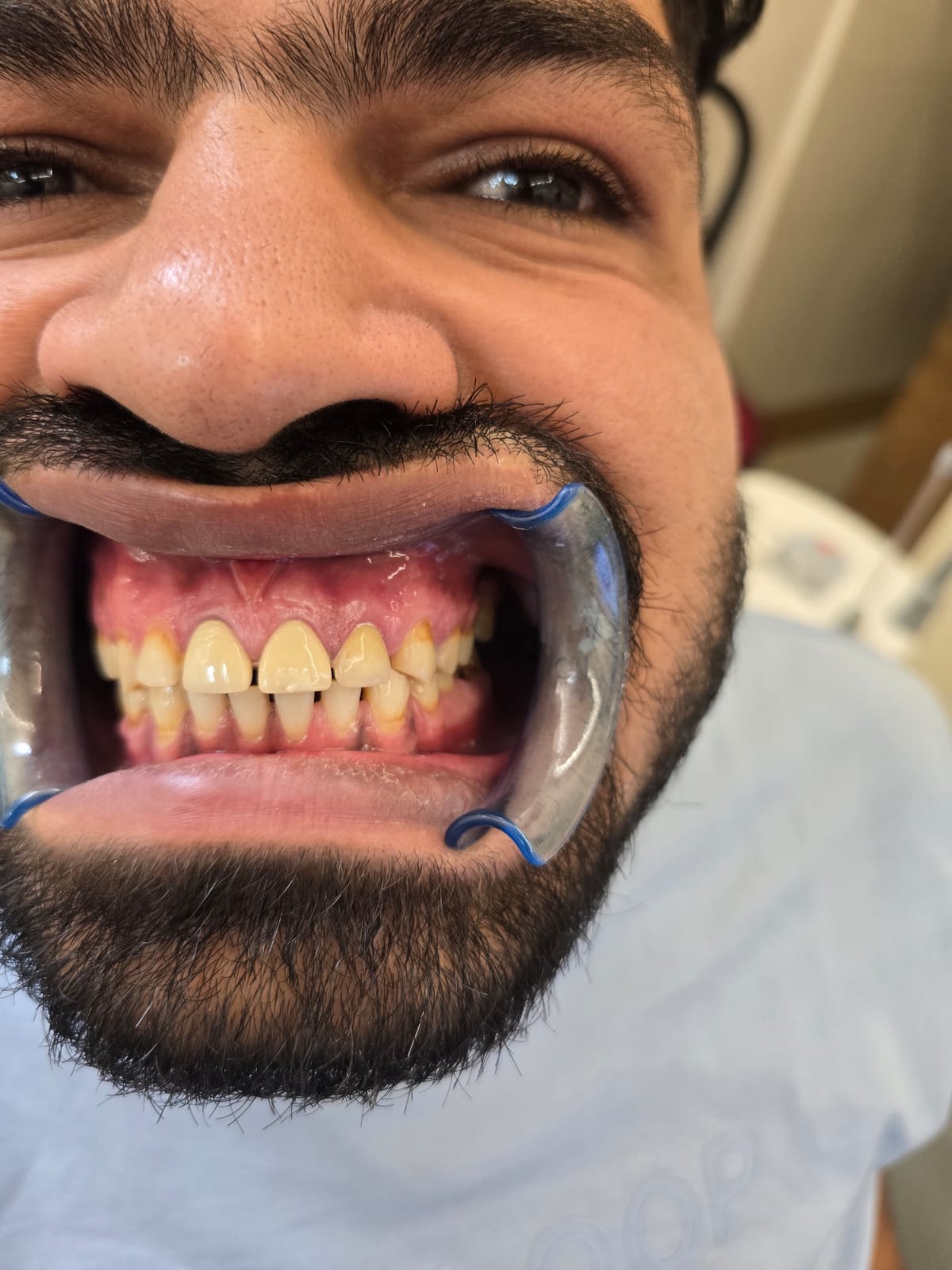 Microscopic Dentistry